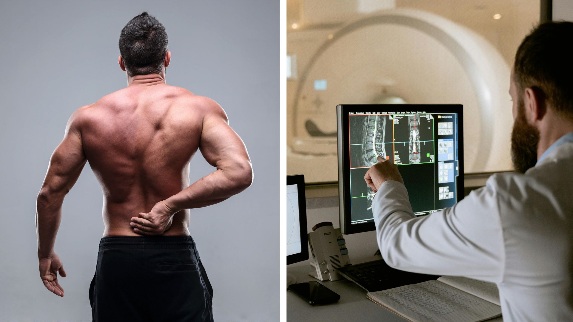 Spine MRI in Hollywood, FL: Fast Diagnosis for Back & Neck Pain