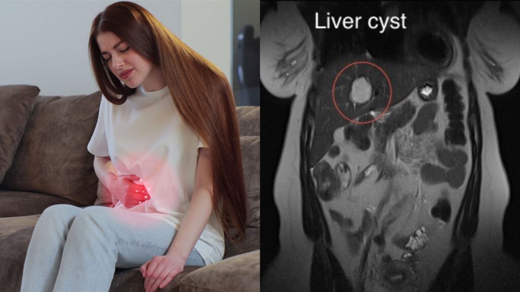 Abdomen & Pelvis MRI Hollywood FL: Get Answers for Pain