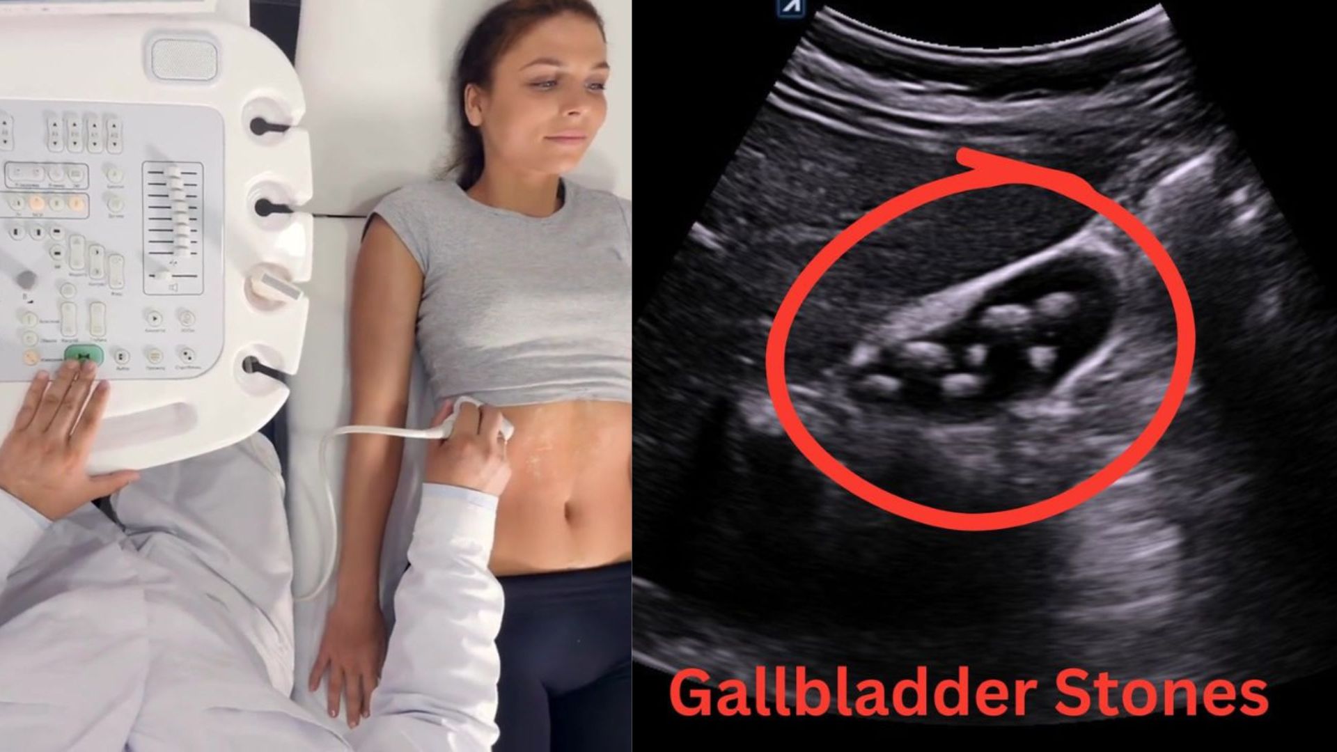 Abdominal Ultrasound Hollywood FL: Stomach Pain & Digestion