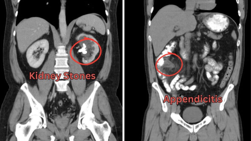 CT Abdomen Pelvis Scan Hollywood FL: Pain, Digestion & Answers
