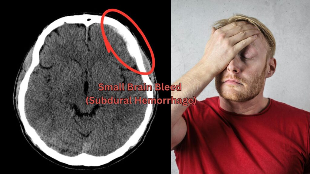 Head CT Scan Hollywood FL: Headaches, Injury & Brain Scans