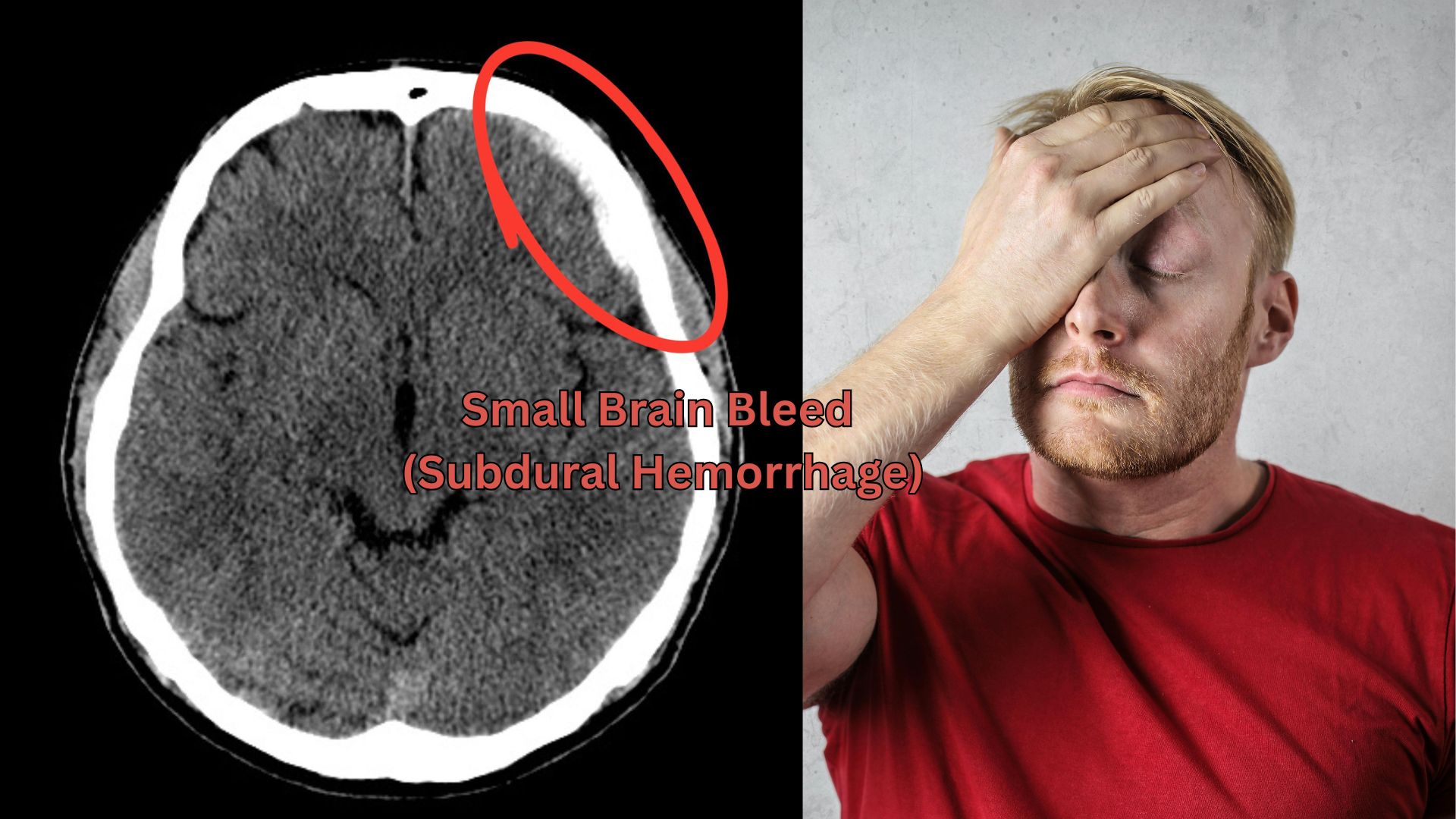 Head CT Scan Hollywood FL: Headaches, Injury & Brain Scans
