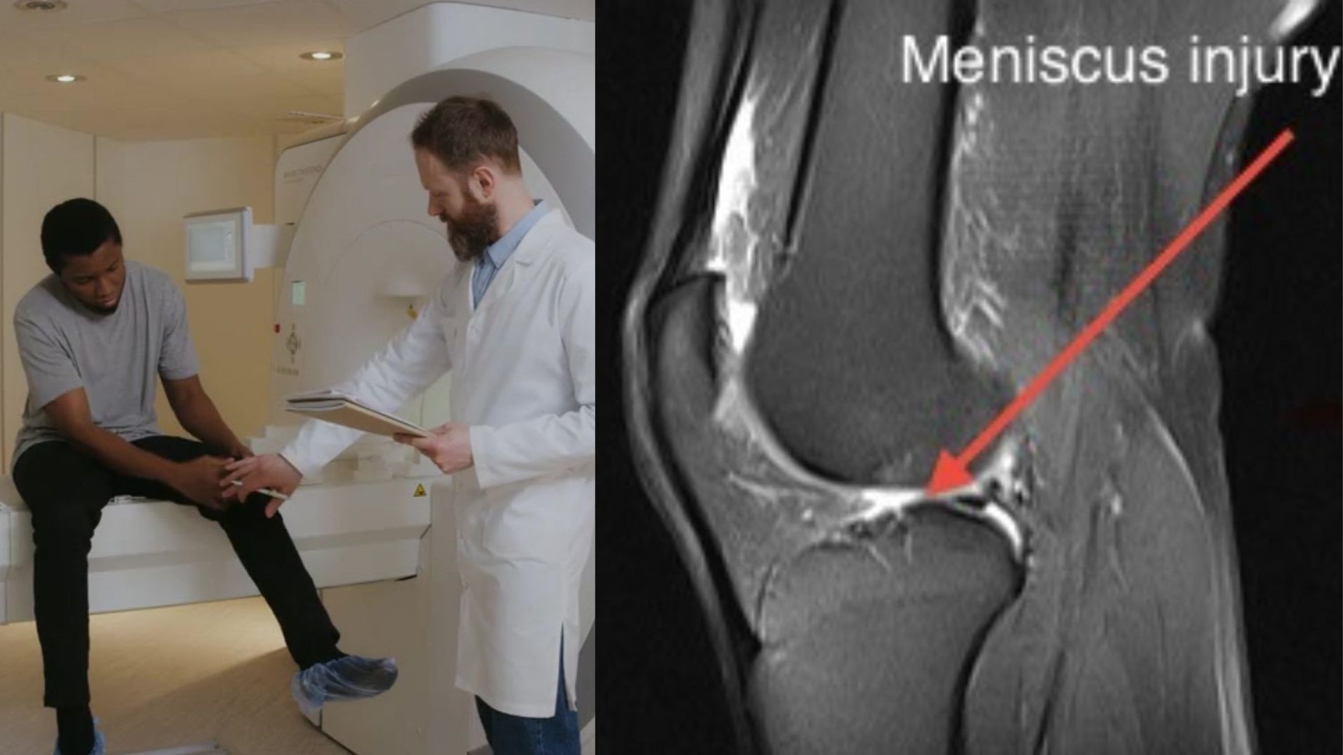 Knee MRI in Hollywood FL: 5 Signs Your Knee Pain Needs a Scan