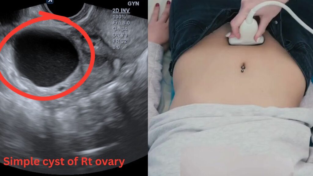 Pelvic Ultrasound Hollywood FL: Pain, Ovarian Cysts, Periods