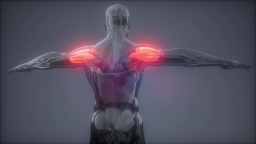 Shoulder MRI Hollywood FL: Diagnose Pain, Rotator Cuff Tears
