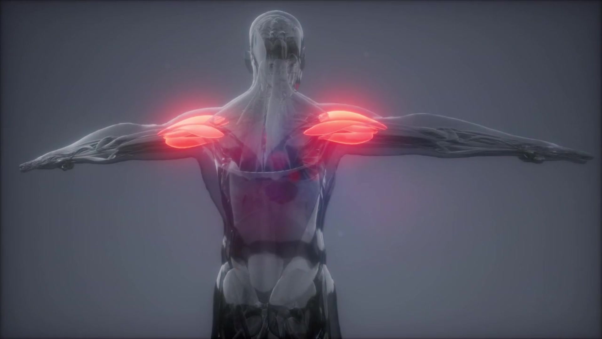 Shoulder MRI Hollywood FL: Diagnose Pain, Rotator Cuff Tears