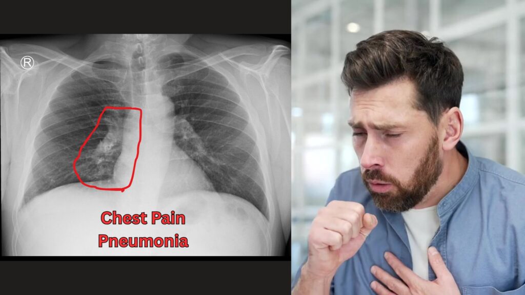 Chest X-ray Hollywood FL: Cough, Pain & Breathing