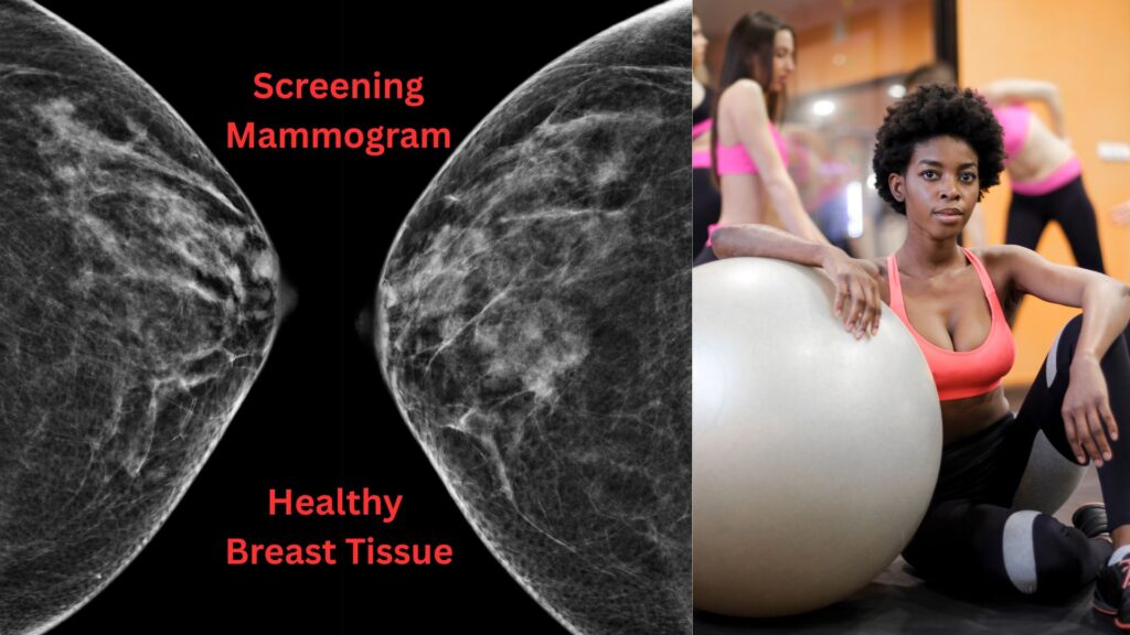 Screening Mammogram Hollywood FL: 3D, Early Cancer Detection